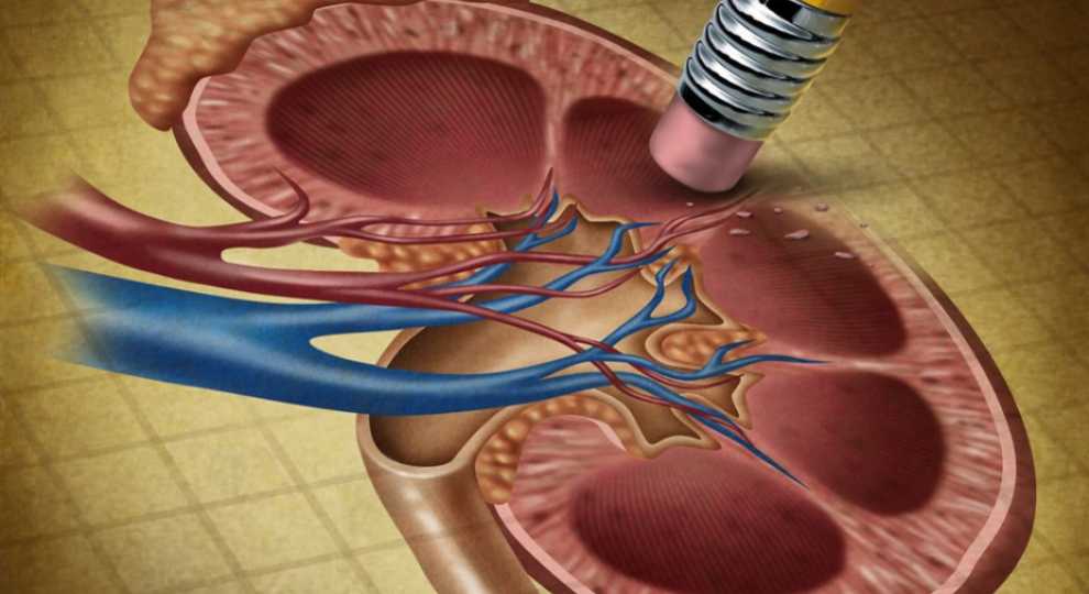 Kidney Cancer in the Light of Current Information