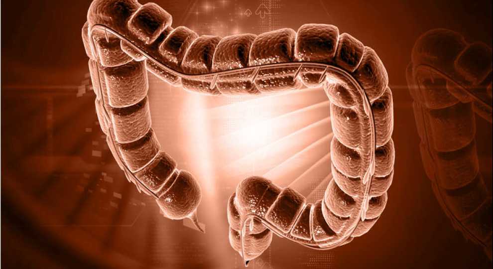 Каковы симптомы рака кишечника?